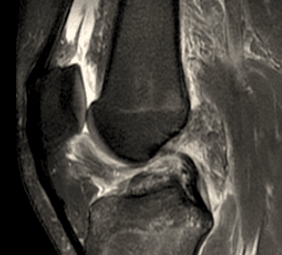 Ortho Reviews - Image