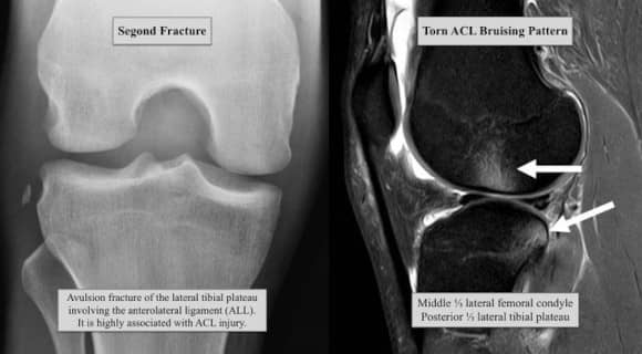 Ortho Reviews - Image