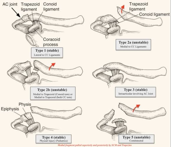 Ortho Reviews - Image