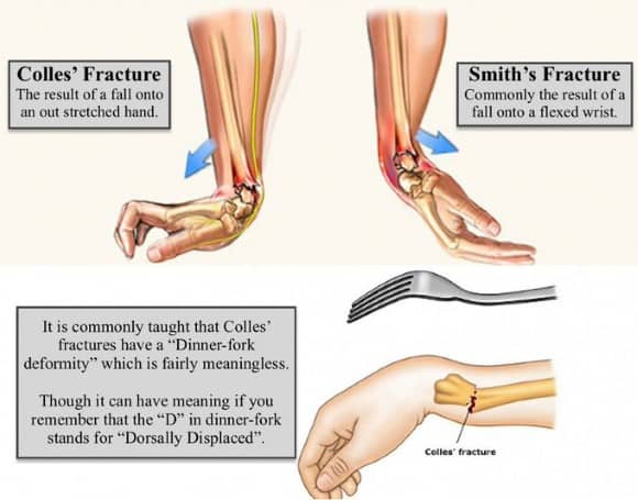 Ortho Reviews - Image