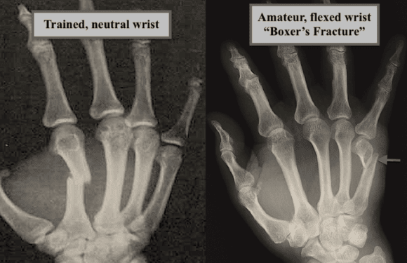 Ortho Reviews - Image