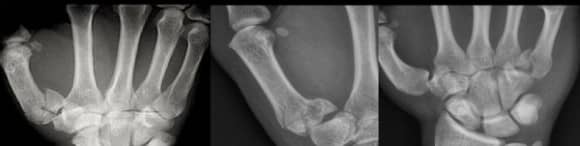 Ortho Reviews - Image