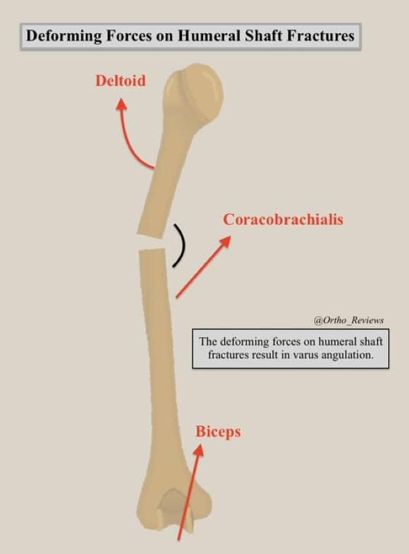 Ortho Reviews - Image