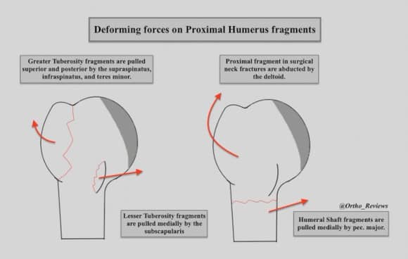 Ortho Reviews - Image