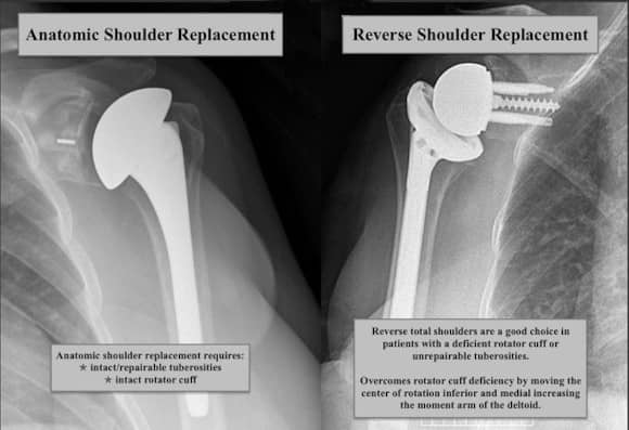 Ortho Reviews - Image