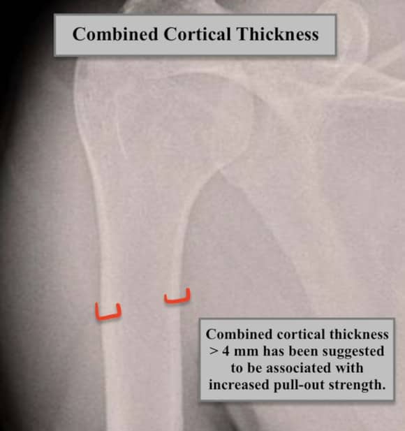 Ortho Reviews - Image