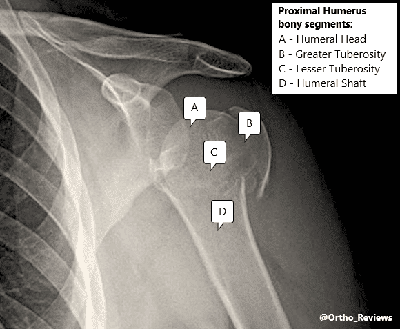 Ortho Reviews - Image