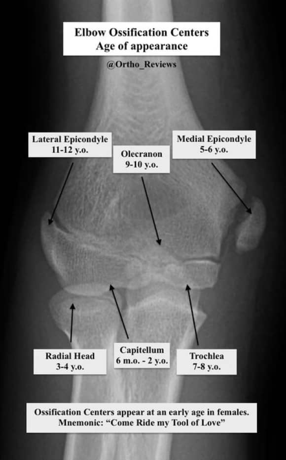 Ortho Reviews - Image