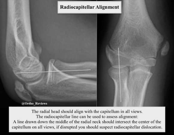 Ortho Reviews - Image