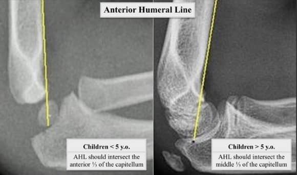 Ortho Reviews - Image