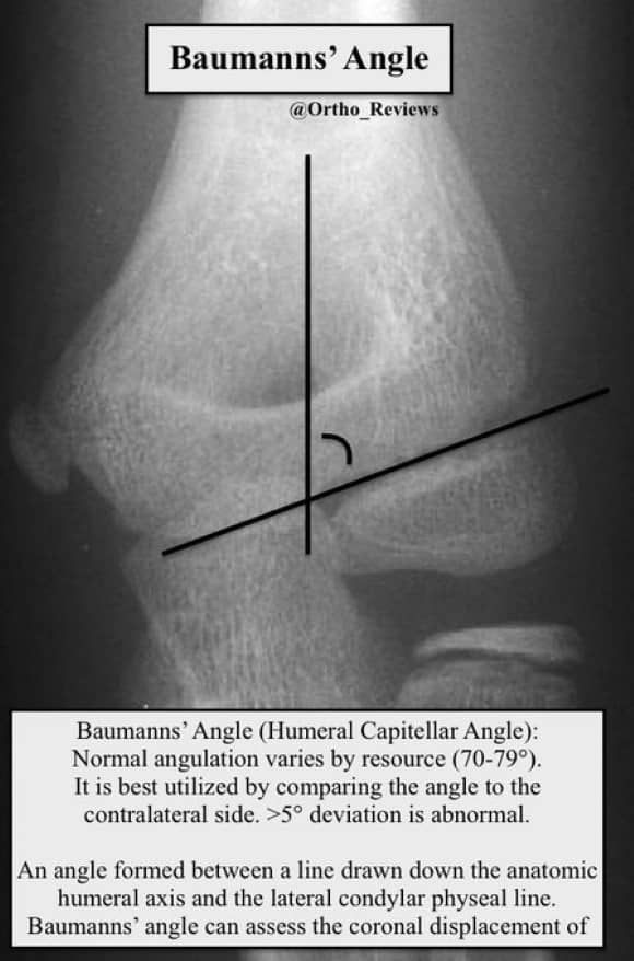 Ortho Reviews - Image