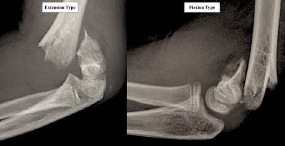 Ortho Reviews - Image