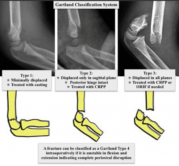 Ortho Reviews - Image