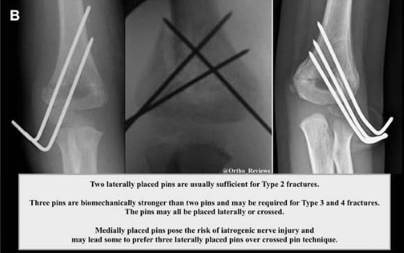 Ortho Reviews - Image