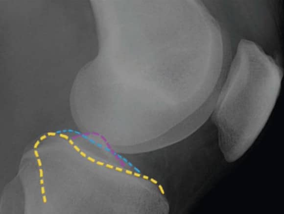 Ortho Reviews - Image