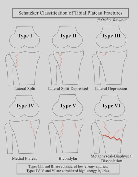 Ortho Reviews - Image