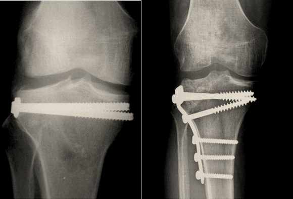 Ortho Reviews - Image