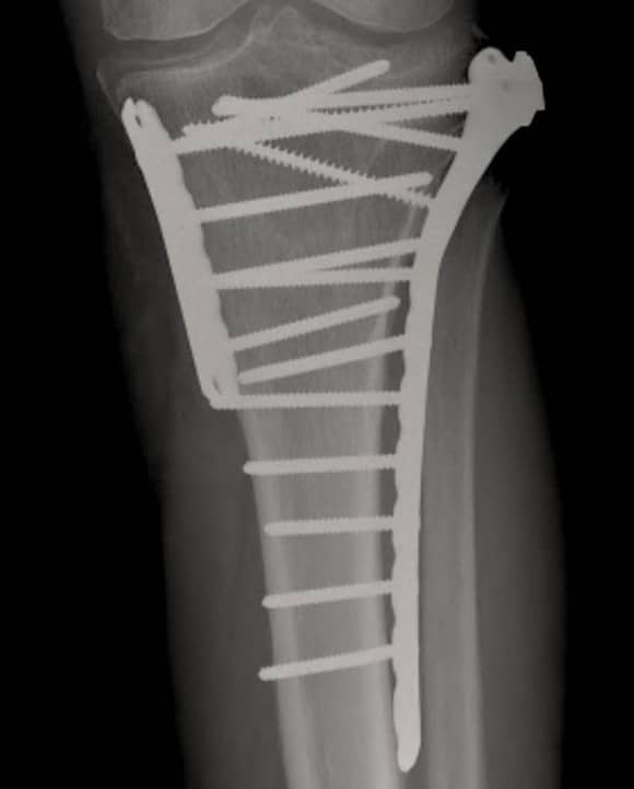 Ortho Reviews - Image