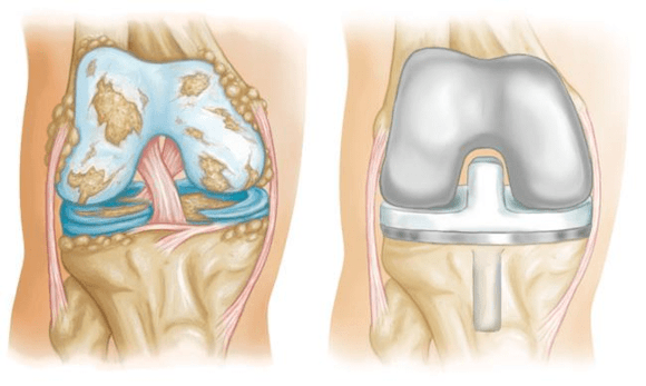 Ortho Reviews - Image