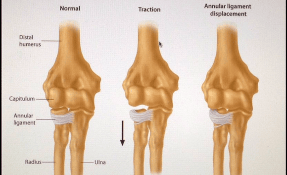 Ortho Reviews - Image