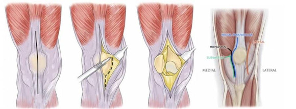 Ortho Reviews - Image