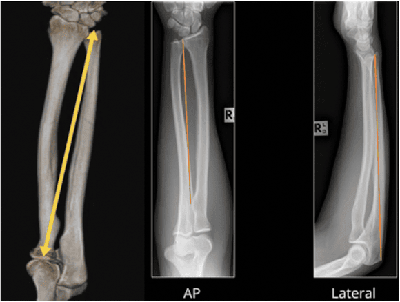 Ortho Reviews - Image