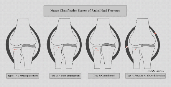 Ortho Reviews - Image