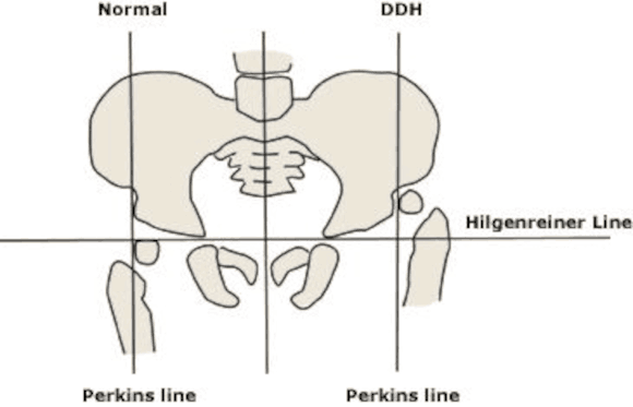 Ortho Reviews - Image