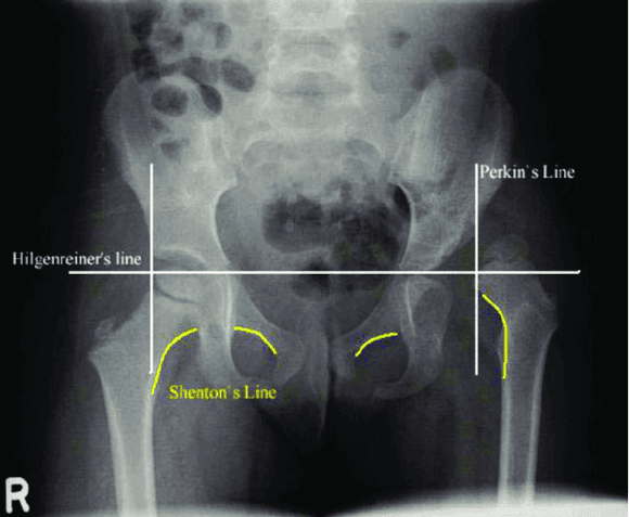 Ortho Reviews - Image