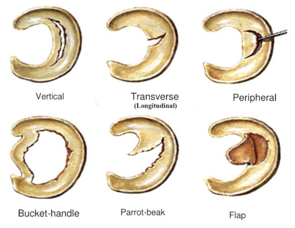 Ortho Reviews - Image