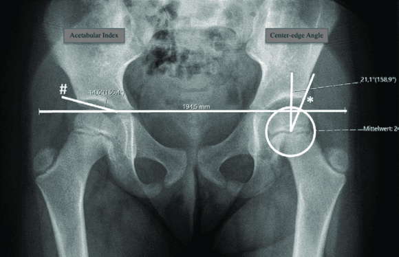 Ortho Reviews - Image