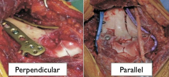 Ortho Reviews - Image