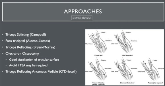 Ortho Reviews - Image