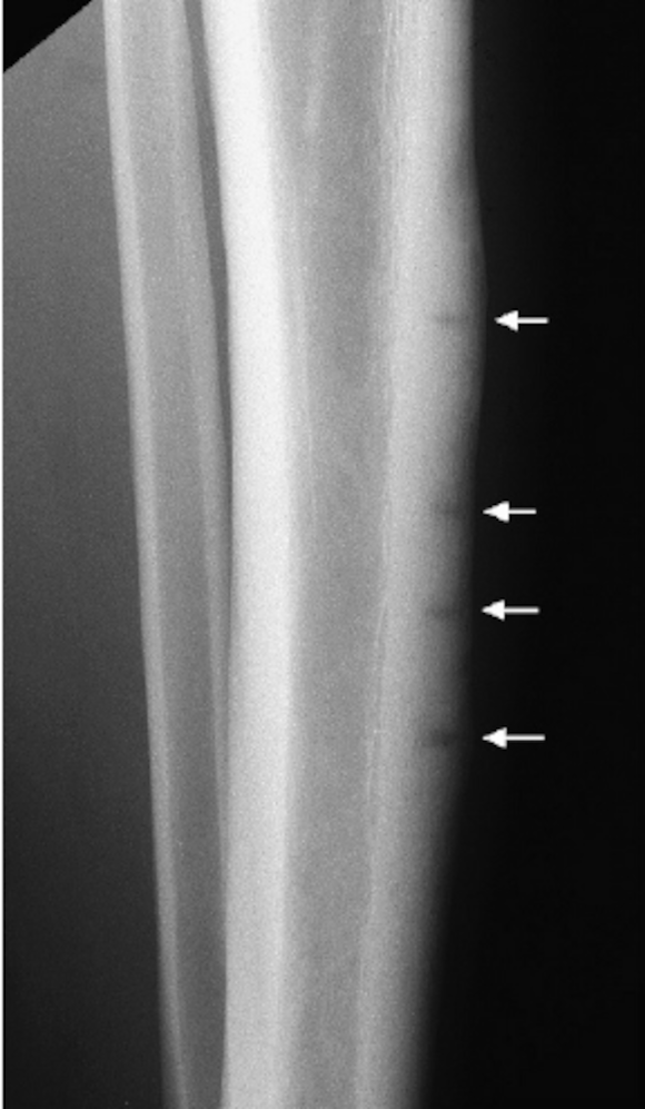 Ortho Reviews - Image