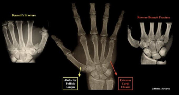 Ortho Reviews - Image