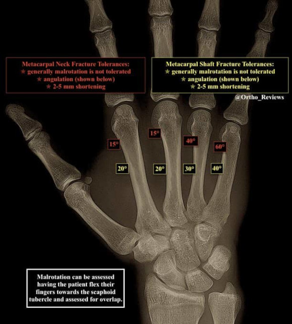 Ortho Reviews - Image