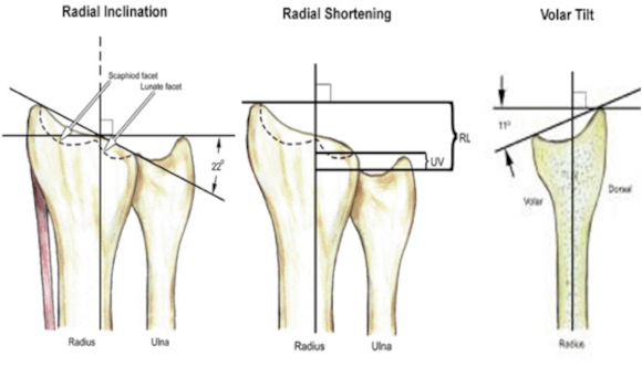 Ortho Reviews - Image