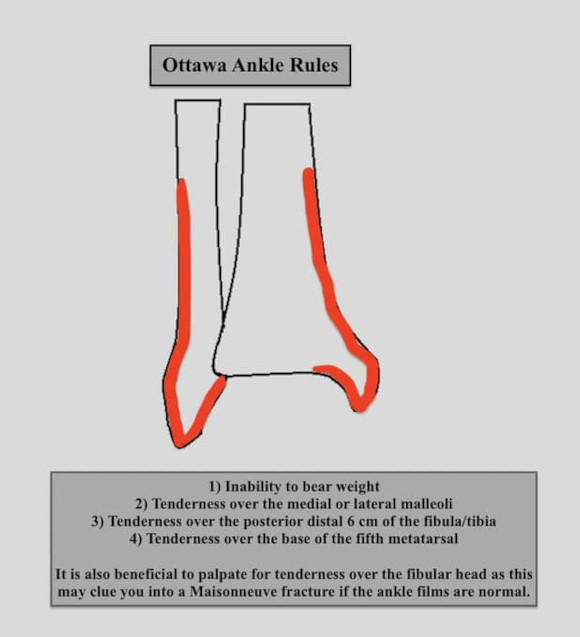 Ortho Reviews - Image