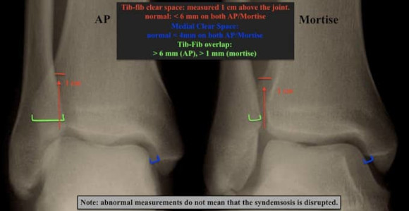 Ortho Reviews - Image