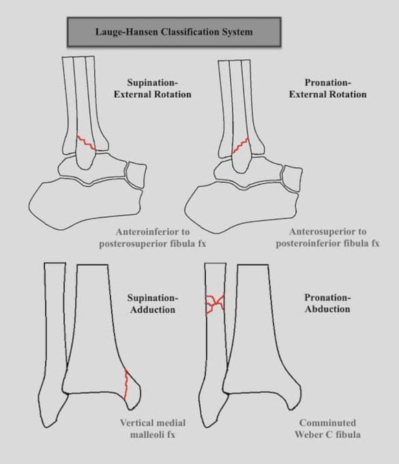 Ortho Reviews - Image