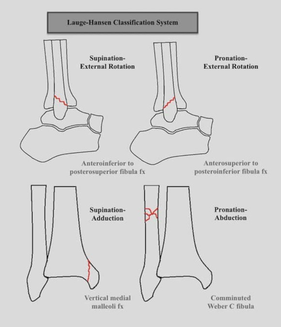 Ortho Reviews - Image