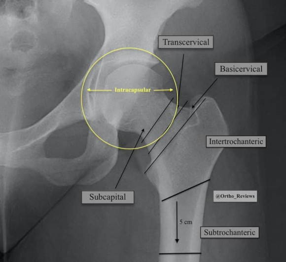 Ortho Reviews - Image