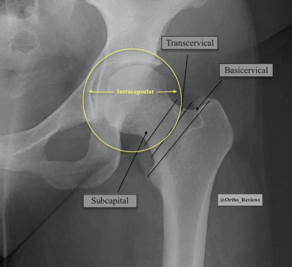 Ortho Reviews - Image