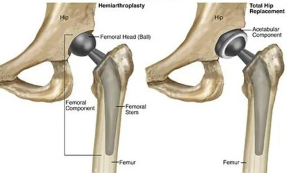 Ortho Reviews - Image