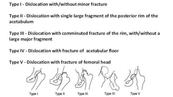 Ortho Reviews - Image