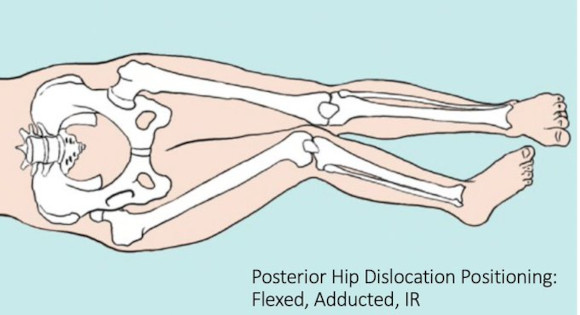 Ortho Reviews - Image