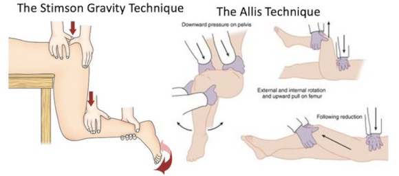 Ortho Reviews - Image