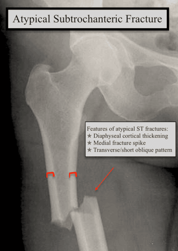 Ortho Reviews - Image