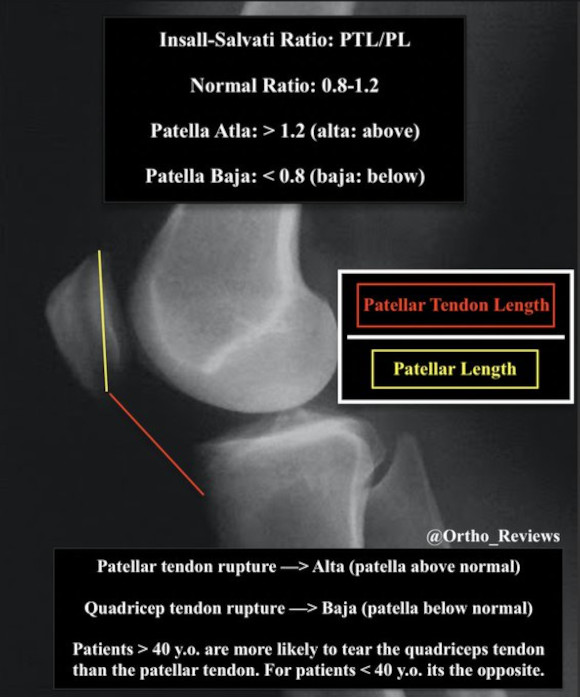 Ortho Reviews - Image