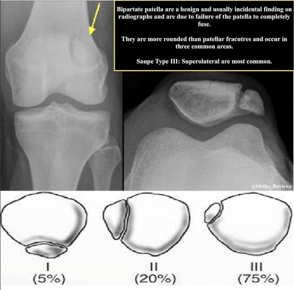 Ortho Reviews - Image